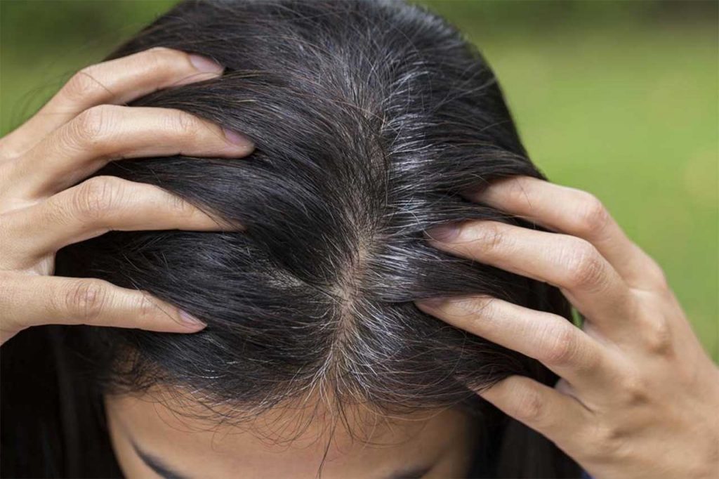 Top 6 Home Remedies To Treat Premature Grey Hair Chakru
